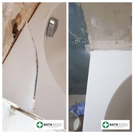 Bath chip repair Glasgow — Bath Medic