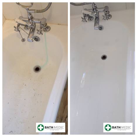Bath re-enamelling Glasgow — Ibis Hotel — Bath Medic