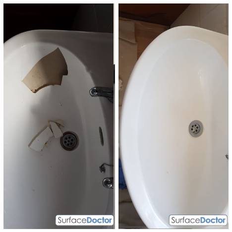 Bath re-enamelling Glasgow specialist work demonstration - Surface Doctor expert applying precision enamel coating using professional spray equipment for factory-quality finish